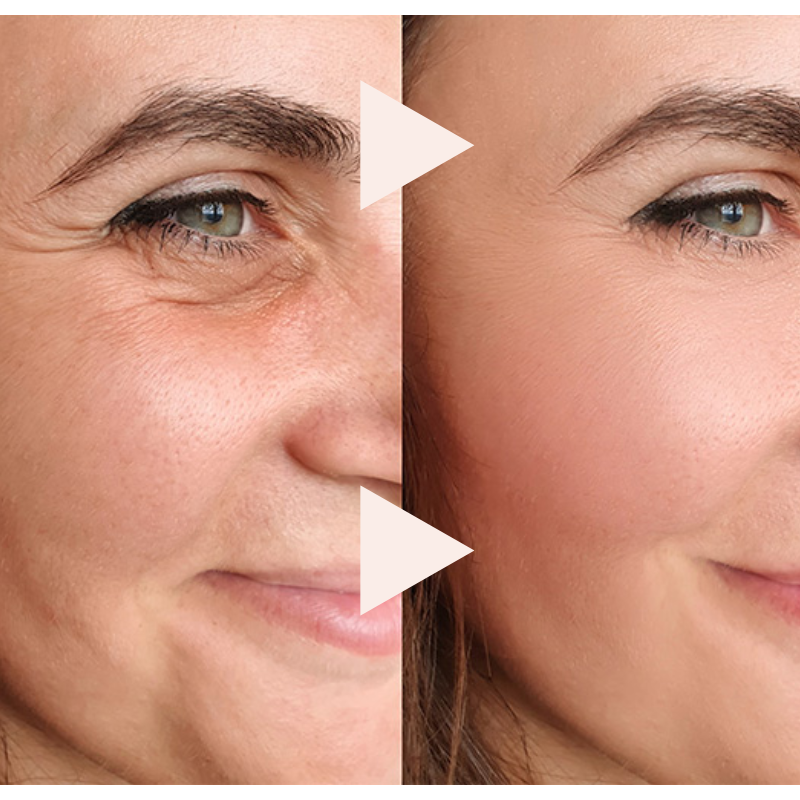 Final 3 Hours: 60% OFFđ„The Express Anti-Wrinkle â Instant Lifting Effect