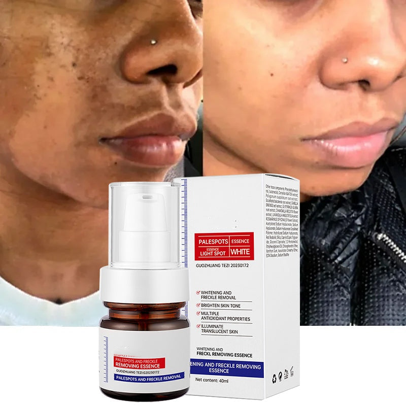 ⚡5-second brightening rescue: Dark spots disappear, blemishes fade, and skin becomes radiant! Vitamin C Whitening Freckles